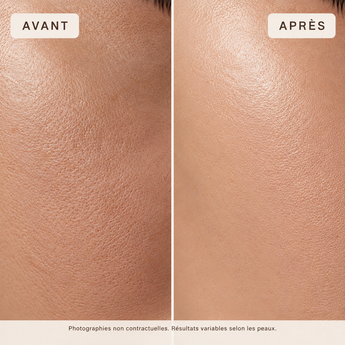 Masque hydrogel PDRN